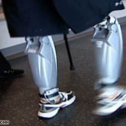 Berkat Bluetooth, Kaki Pun Bisa Melangkah Kembali